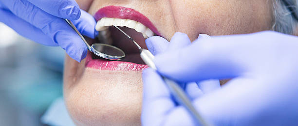Best Emergency Dental Care for Broken or Chipped Teeth in Ransomville, NY